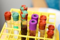 Bloedtest vindt teelbalkanker die de gewone test mist